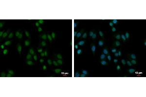 ICC/IF Image PABPN1 antibody detects PABPN1 protein at cytoplasm and nucleus by immunofluorescent analysis. (PABPN1 Antikörper)