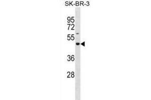 Western Blotting (WB) image for anti-Glucoside Xylosyltransferase 2 (GXYLT2) antibody (ABIN3001024) (GXYLT2 Antikörper)