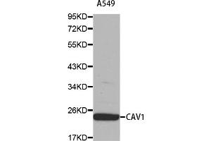 Western blot analysis of extracts of A-549 cells, using CAV1 antibody (ABIN5969989). (Caveolin-1 Antikörper)