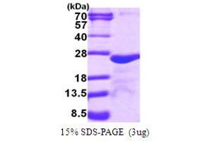 SDS-PAGE (SDS) image for Myosin, Light Chain 5, Regulatory (MYL5) (AA 1-173) protein (His tag) (ABIN667957)