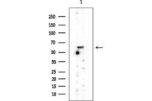 anti-Asparagine-Linked Glycosylation 6, alpha-1,3-Glucosyltransferase Homolog (ALG6) antibody