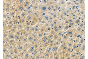 ABIN6262126 and ABIN6279461 at 1/100 staining Mouse liver tissue by IHC-P. (GTPBP1 Antikörper  (Internal Region))