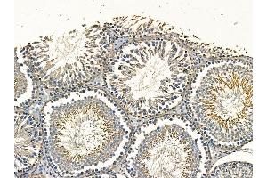 ABIN7095300 and ABIN7099357 at 1/100 staining rat testis tissue by IHC-P.