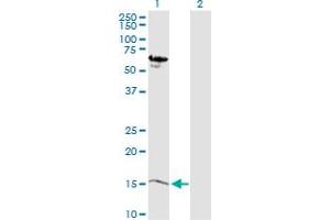 Western Blot analysis of MB expression in transfected 293T cell line by MB MaxPab polyclonal antibody. (Myoglobin Antikörper  (AA 1-154))