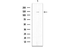 Western blot analysis of lysates from COLO205 cells(heat-shock treatment), using c-Kit Mouse Monoclonal Antibody.