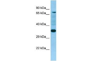 WB Suggested Anti-SELPLG Antibody Titration: 1. (SELPLG Antikörper  (N-Term))