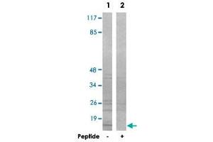 Western blot analysis of extracts from rat heart cells, using COX7A2P2 polyclonal antibody . (COX7A2P2 Antikörper)