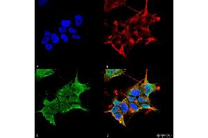 Immunocytochemistry/Immunofluorescence analysis using Mouse Anti-GABA-A Receptor Alpha4 Monoclonal Antibody, Clone S398A-34 . (GABRA1 Antikörper  (AA 410-450) (Biotin))