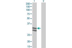 Western Blot analysis of SERPINC1 expression in transfected 293T cell line by SERPINC1 monoclonal antibody (M02), clone 2B12. (SERPINC1 Antikörper  (AA 1-259))