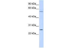 WB Suggested Anti-FAM124A Antibody Titration: 0. (FAM124A Antikörper  (Middle Region))