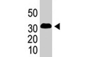 The SNAI1 polyclonal antibody  is used in Western blot to detect SNAI1 in SNAI1-293 cells (flag-tagged) . (SNAIL Antikörper  (AA 9-39))