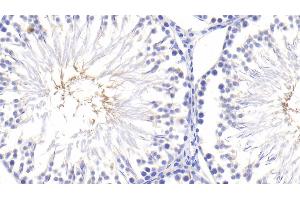 Detection of TNFa in Rat Testis Tissue using Polyclonal Antibody to Tumor Necrosis Factor Alpha (TNFa) (TNF alpha Antikörper  (AA 80-235))