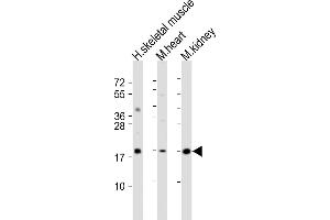 All lanes : Anti-SDHC Antibody (C-Term) at 1:2000 dilution Lane 1: human skeletal muscle lysate Lane 2: mouse heart lysate Lane 3: mouse kidney lysate Lysates/proteins at 20 μg per lane. (SDHC Antikörper  (AA 113-144))