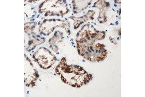Immunohistochemical analysis of Factor XII HC staining in human kidney formalin fixed paraffin embedded tissue section. (F12 Antikörper  (Heavy Chain, N-Term))