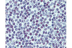 anti-Upstream Binding Transcription Factor, RNA Polymerase I (UBTF) (AA 551-651) antibody