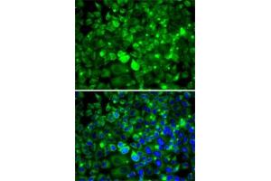 Immunofluorescence analysis of MCF7 cells using RPLP1 antibody (ABIN6129657, ABIN6147166, ABIN6147167 and ABIN6222445). (RPLP1 Antikörper  (AA 1-114))