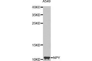 Western blot analysis of extracts of A549 cell line, using NPY antibody. (NPY Antikörper  (AA 1-97))