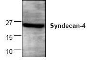 Image no. 1 for anti-Syndecan 4 (SDC4) antibody (ABIN127275) (SDC4 Antikörper)