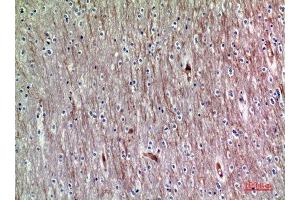 Immunohistochemistry (IHC) analysis of paraffin-embedded Human Brain, antibody was diluted at 1:200. (ADAMTS18 Antikörper)