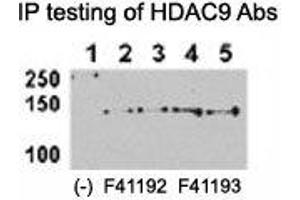 HDAC9 antibody NSJ# F41192 and NSJ# F41193 can both immunoprecipitate the protein from HeLa-HDAC9 tranfected cells.