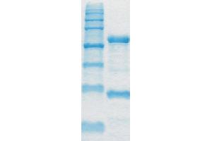 Image no. 1 for anti-Toxin B antibody (ABIN335173) (Toxin B Antikörper)