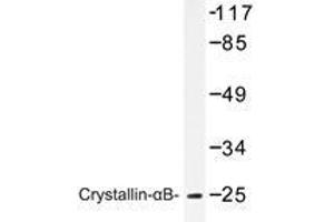 Western blot analysis of Crystallin-αB antibody in extracts from mouse lung cells. (CRYAB Antikörper)