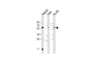 Western Blot at 1:2000 dilution Lane 1: HepG2 whole cell lysate Lane 2: Hela whole cell lysate Lane 3: HL-60 whole cell lysate Lysates/proteins at 20 ug per lane. (PI4K2A Antikörper  (C-Term))
