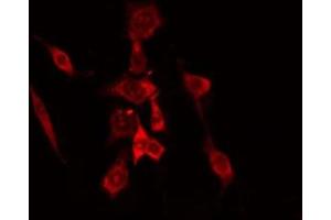 ABIN6275145 staining COLO205 cells by IF/ICC. (GCP6 Antikörper  (Internal Region))