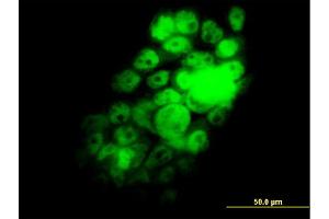 Immunofluorescence of monoclonal antibody to RBM9 on A-431 cell. (RBM9 Antikörper  (AA 1-100))
