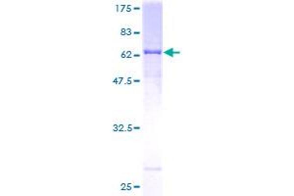 Renin Protein (REN) (AA 24-406) (GST tag)