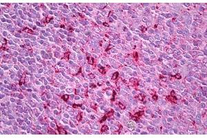 Anti-Cathepsin S antibody IHC staining of human tonsil. (Cathepsin S Antikörper)