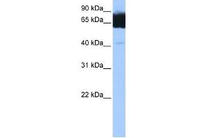 Image no. 1 for anti-Tetratricopeptide Repeat Domain 12 (TTC12) (C-Term) antibody (ABIN631929) (TTC12 Antikörper  (C-Term))