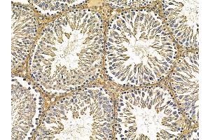 ABIN7095632 and ABIN7099694 at 1/100 staining rat testis tissue by IHC-P. (ETF1 Antikörper)