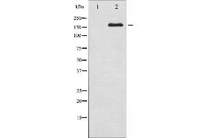Western blot analysis of IRS-1 expression in NIH-3T3 whole cell lysates,The lane on the left is treated with the antigen-specific peptide. (IRS1 Antikörper)