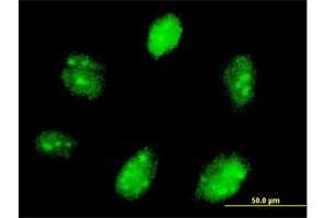 Immunofluorescence of purified MaxPab antibody to ETV7 on Daoy cell. (ETV7 Antikörper  (AA 1-341))