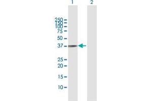 Western Blotting (WB) image for anti-Replication Factor C (Activator 1) 4, 37kDa (RFC4) (AA 1-363) antibody (ABIN519749)
