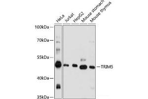 Western blot analysis of extracts of various cell lines using TRIM5 Polyclonal Antibody at dilution of 1:1000. (TRIM5 Antikörper)