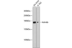 Western Blotting (WB) image for anti-Lysine (K)-Specific Demethylase 6B (Kdm6b) (AA 265-450) antibody (ABIN6142806)