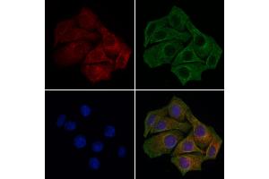 ABIN7094794 and ABIN7098845 staining HepG2 cells by IF/ICC.