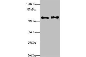 Western blot All lanes: NMT2 antibody at 4.