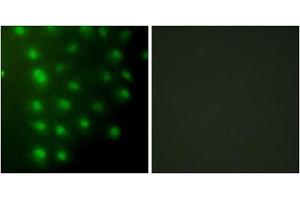 Immunofluorescence analysis of HUVEC cells, using AKAP8 antibody. (AKAP8 Antikörper  (Internal Region))