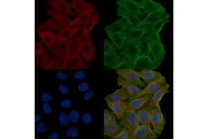 ABIN7094065 and ABIN7098109 staining Hela cells(24h of starvation treatment) by IF/ICC. (AP2B1 Antikörper  (N-Term))