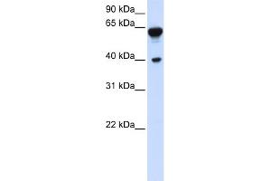 WB Suggested Anti-DTNB Antibody Titration:  0. (Dystrobrevin beta Antikörper  (C-Term))