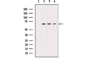 Western blot analysis of extracts from various samples, using ETFDH Antibody. (ETFDH Antikörper  (C-Term))