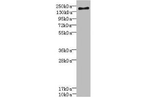 Western blot All lanes: SCN7A antibody at 2. (SCN7A Antikörper  (AA 265-368))