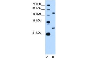 Western Blotting (WB) image for anti-BCL2-Like 1 (BCL2L1) antibody (ABIN2460189) (BCL2L1 Antikörper)