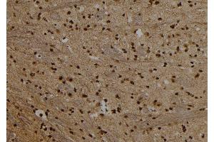 ABIN6279684 at 1/100 staining Rat brain tissue by IHC-P. (PRDM10 Antikörper  (C-Term))