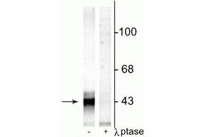 Western blot of rat hippocampal lysate showing specific immunolabeling of the ~43 kDa connexin43 phosphorylated at Ser368 in the first lane (-). (Connexin 43/GJA1 Antikörper  (pSer368))
