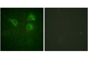 Immunofluorescence analysis of HuvEc cells, using CDC25B (Ab-323) Antibody. (CDC25B Antikörper  (AA 289-338))