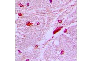 Immunohistochemical analysis of CUX1 staining in human brain formalin fixed paraffin embedded tissue section.